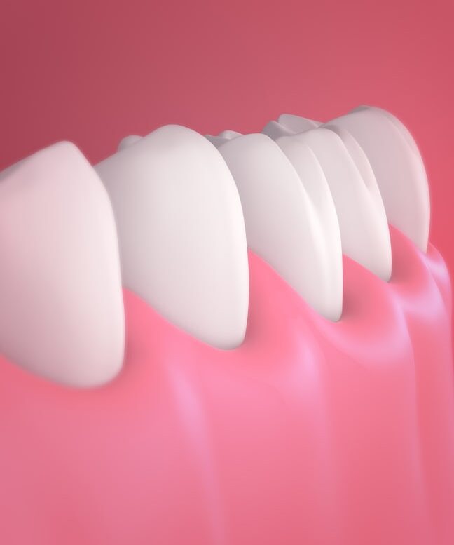 Treatment -  St Mawes Dental
